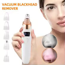 Blackhead Remover